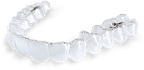 clear-aligners-2